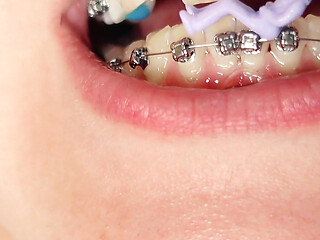 Giantess Devour Fetish in Braces