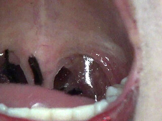 Super Spectacle Swallowing Big Spiders!