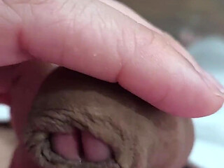 The Head of My Penis