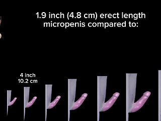 1.9 inch (4.8cm) erect micropenis ultra tiny hard cock size compared