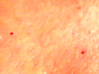 Scandal on the Cruiseship