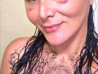 Day 8 Face Lift Recovery....