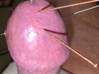Acupuncture - Orgasm!