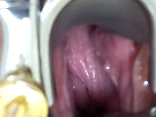 My Speculum Opens Me up