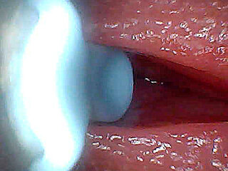I couldn't believe what happens INSIDE the penis as sperm passes through (endoscopic footage)