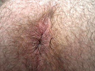 Hairy ass that everyone wishes to fuck