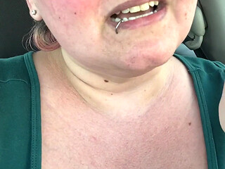 Got a Sunburn for Art Supplies!