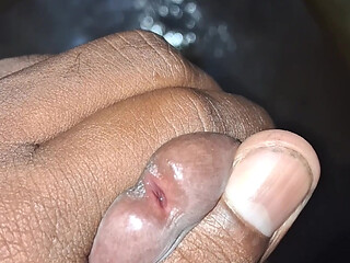 Masturbation is the self-stimulation of genitals for sexual pleasure, often leading to orgasm.
