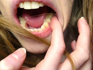 I Tell You About the Fillings in My Teeth and Dental Visits