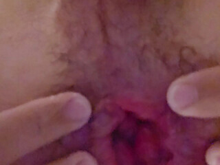 Working hard on my prolapse