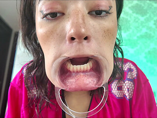 Cheeks Pulled Apart Teeth Exposed
