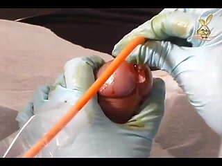 The rubber doctor