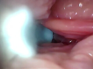 Semen in Cervix Wide Stretching Pussy Endoscope!