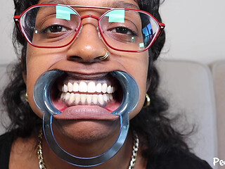 Youronlyphoenix Dental Retractor Mouth Tour
