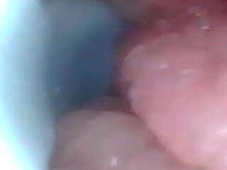 Exclusive: Camera Goes Inside - We Found My G-spot and Captured 5 Orgasms!