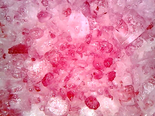 Medical Endoscope Oral Exam: Gummy Chewing, Extreme Teeth & Tongue Macro