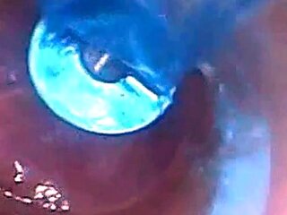 Endoscope POV: Test Tube Cock Urethral Insertion