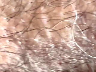Closeup of Penis with One Vein