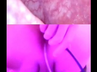 Let'_s take a look with the Endoscope and find out how my ass looks deep inside!