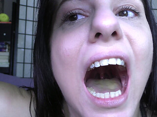 My Uvula