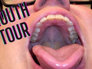 Mouth Tour with a Bottom Retainer