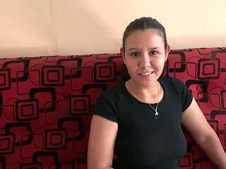 Una Arana Me Pico Y La Vecina Dice Saber Sacarme El Veneno