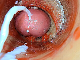 Camera Inside Deep Pussy Captures Overdose Ejaculation of Sperm Asmr