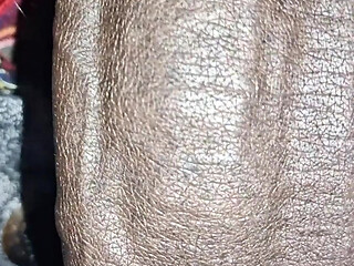 Close up on These Thick Veins