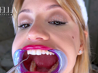 Mouth Retractor Teeth Examination