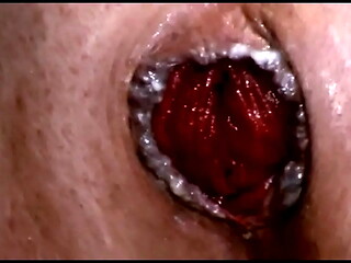 FREE! Urethral Penetration, Double Anal, Deepthroat and More!