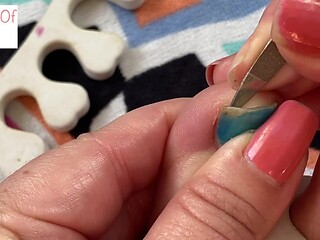 Removal of Blue Toenail Polish Exposed
