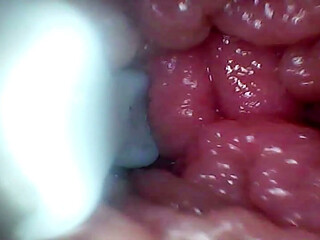Endoscope Camera Records My Wife's G Spot. Educational Video Close up
