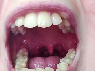 Throat Fetish