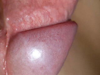 Amazing Upright Rough Venous Frenulum