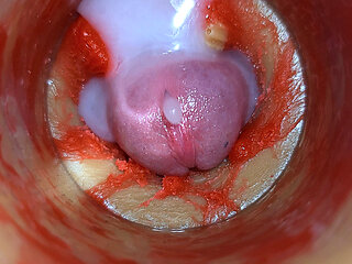 Camera Inside Deep Pussy Captures Very Huge Ejaculation of Sperm ASMR