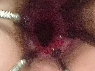 Enema, anal shower. Close-up view through anal mirror. Anal with water. Filling anal with water
