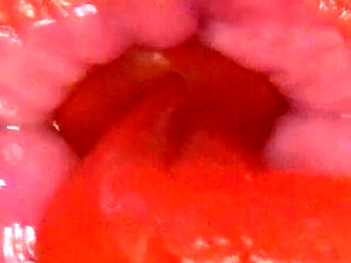 Omg! I Swallowed Big Flamingos at the Same Time!