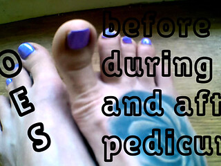 Lady Angela Hand Held Toesbefore a Pedicure