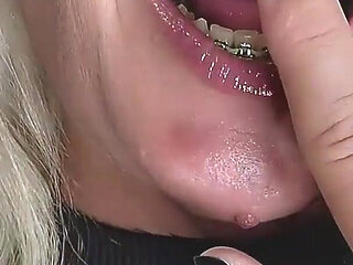 Licking and Sucking My Metal Braces